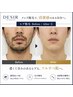 メンズ◇ヒゲ脱毛YUIMARLのお客様★お試し限定価格¥8800→