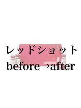 ジョアアンジェ 京橋店(joie ange)/レッドショット