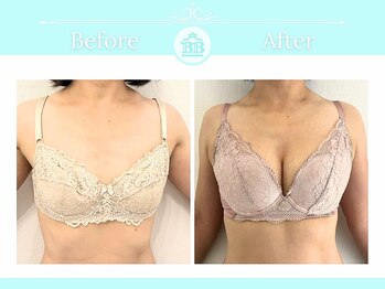 ルフルリール(Refleurir)の写真/【痩せ型/産後垂れ/バストの脂肪が腕やお腹に流れている】バストアップ専門店オリジナルマシーンで結果出し