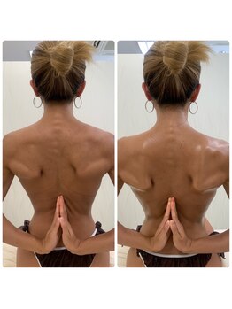 ソルニス(Solnis.)/痩身☆脂肪分解/ハイパーナイフ