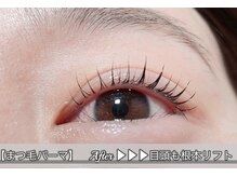 ブラックスワン(Black Swan)/