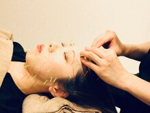 クマノミ美容鍼灸 銀座院(KUMANOMI美容鍼灸)