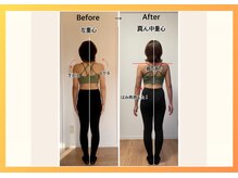 ラ キュート(LA-9TE)/美容矯正/姿勢改善/代謝改善