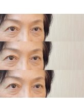 シアミス(SIAMIHS)/まつげパーマ