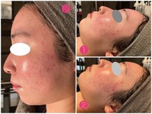 サロン デ ミロ(Salon de Miro)/BeforeAfter多数！ブログへGO♪