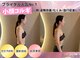 レディアンスの写真
