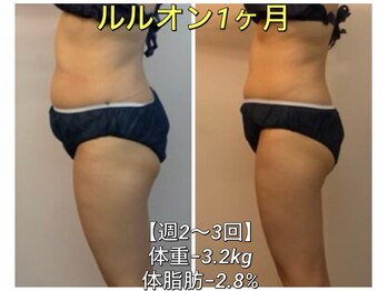 ヨサパーク カルム(YOSA PARK)/回数券で通われたお客さま