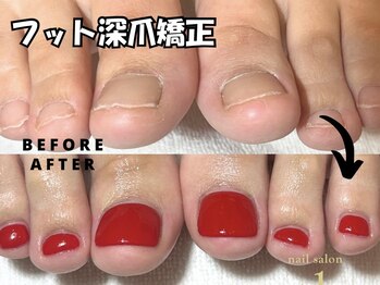 プラスワン(+1)の写真/【手爪・足爪の専門家】人前で手を出せない,他店で満足できなかった方も見た目改善!知識豊富な当店にお任せ