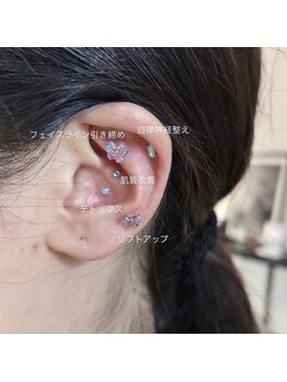 プリュネ(Prune)/耳つぼジュエリー/デトックス