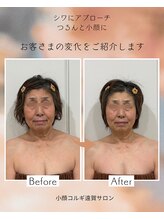 遠賀サロン/ビフォーアフター