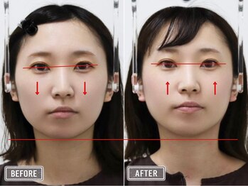 さつま骨格矯正 表参道青山院/歪み小顔矯正＋骨盤矯正