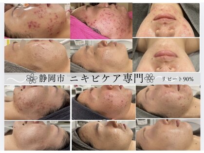 ビューティーブルーム(BeautyBloom)の写真