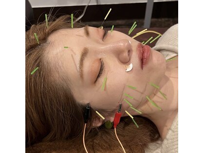 ロミハリ(LomiHari)の写真