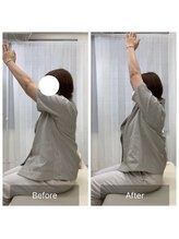 ナオル整体 三鷹院(NAORU整体)/30代女性施術事例【肩関節屈曲】