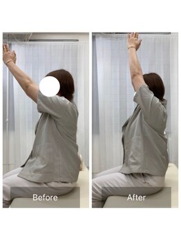 ナオル整体 三鷹院(NAORU整体)/30代女性施術事例【肩関節屈曲】