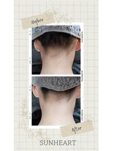 サンハート(SUN HEART)/後ろ姿美人に♪うなじ脱毛