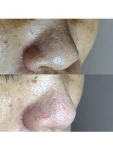 シャイニー(SHINY)/50代女性