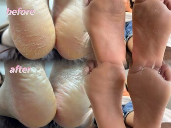 ウィズサロン(withサロン)/韓国式!足裏角質ケア