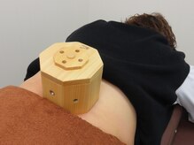 そよな はり灸整骨院/お灸