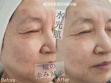 シファ(Sifa.)/ホワイトスノーピール