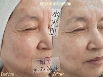 シファ(Sifa.)/ホワイトスノーピール