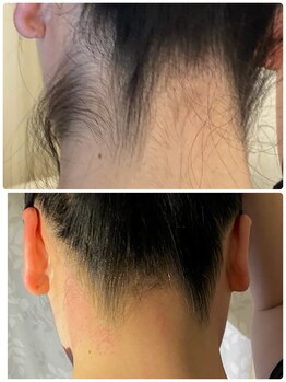 マノ ア マノ(Mano A Mano)/うなじwaxで首をスッキリ!