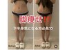 特許取得！ラジオ波WINBACK【上下部位別】90 分　¥13,800→¥9,800