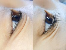 シャイン(shine)/ナチュラル