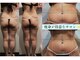 バベルトータルビューティー 北堀江店(Babel Total Beauty)の写真