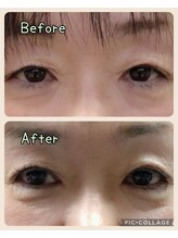 ゆり鍼灸/まるで別人！！