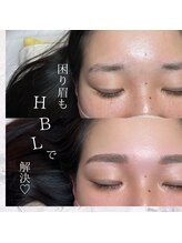 テテ(TeTe)/ハリウッドブロウリフト