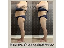 ミノ 美里大通り店(mino)/ダイエットパッケージ
