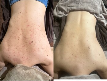 エミルカ 自由が丘店(EMILUCA)/