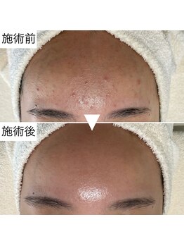 シェノン 赤坂大濠店/