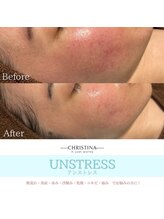 フルアナ(Hu ruana)/フェイシャルエステ