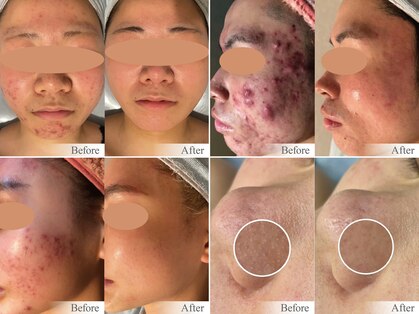 韓美 表参道店(HANMI)の写真