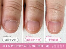 フェリエ(feerie)/Before/After【feerie立川】