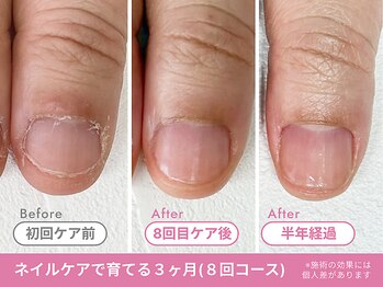 Before/After【feerie立川】