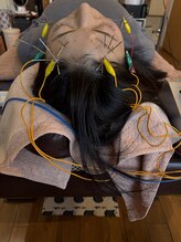 爽健美/電気を流す美容鍼