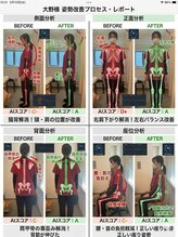 ふじさわ整体院/AI姿勢分析