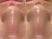 ミュー 岡崎店(mieux)の雰囲気（★毛穴の黒ずみ対策！定期的なメンテナンスとスキンケアで改善♪）