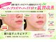 ブールドネージュ(Boule de Neige)の写真