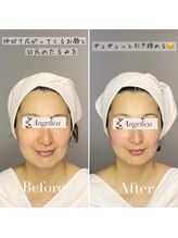 アンジェリカ(Angelica)/1回で疲れ顔とたるみ改善♪