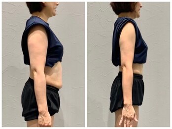 ネクストボディ ゆめタウン廿日市店(NEXT BODY)/【2ヶ月のビフォーアフター】