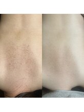 エミルカ 自由が丘店(EMILUCA)/