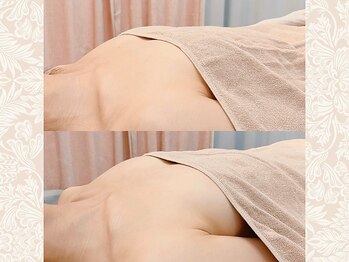 アネラ 北浜(ANERA)/20代/肩凝り&冷え性/バストケア