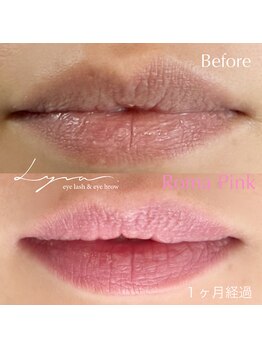 リラ(Lyra)/ローマピンク