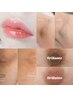 韓国人気NO1メラニンケア（乳輪）カウンセリング