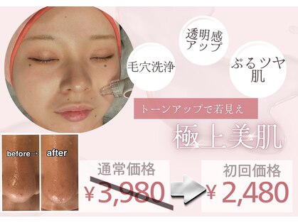 モア(MORE)の写真