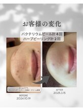 ココフルール(Cocofleur)/お肌に合わせたフェイシャルケア